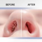 12/8Pcs Dual-Sided Nose Hair Trimmer, 2-In-1 Nose Hair Removal Tool, Portable Manual 360? Rotating Nose Hair Trimmer With Ear Pick, Suitable For Women And Me - Image 7