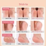 1 Pair Moisturizing Heel Sleeves For Women And Men, Silicone Moisturizing Heel Socks, Exfoliates, Softens, And Supports Heels, Preventing Your Heel From Cracking - Image 12