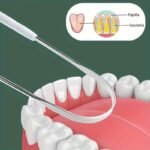 1Pc Stainless Steel Tongue Scraper Cleaner - Durable Metal Tongue Brush To Coating, Bad Breath, Improve Oral Hygiene, Mouth Care Accessory|Stainless Steel Design|Durable Construction - Image 9