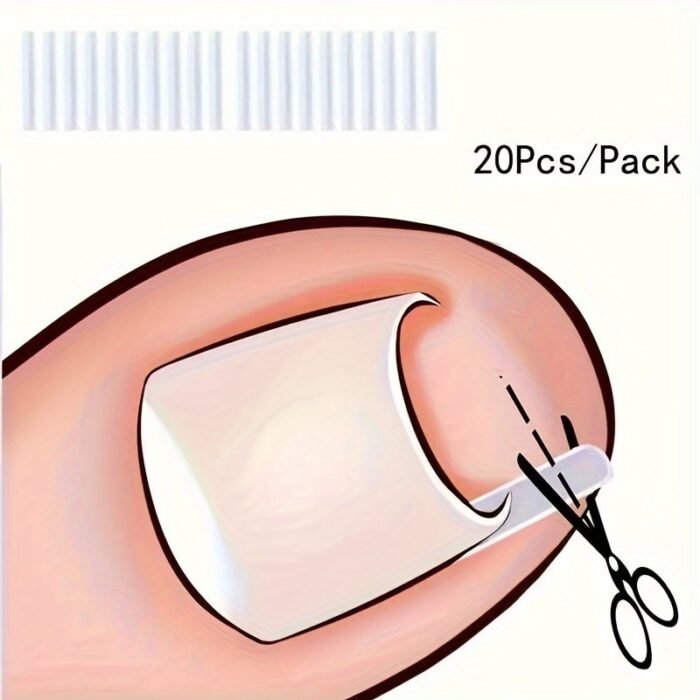 10/20/60Pcs Unscented Ingrown Toenail Strips, Brace Ingrown Toenail, Pedicure Tool, Toenail Patch For Ingrown Toenail - Image 5