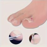 10/20/60Pcs Unscented Ingrown Toenail Strips, Brace Ingrown Toenail, Pedicure Tool, Toenail Patch For Ingrown Toenail - Image 2