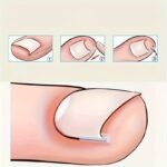 10/20/60Pcs Unscented Ingrown Toenail Strips, Brace Ingrown Toenail, Pedicure Tool, Toenail Patch For Ingrown Toenail - Image 8