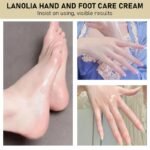 20G Rozino Hand & Foot Cream - Anti-Exfoliating, Hydrating With Hyaluronic Acid & Glycerin, Softening & Smoothing For Dry Cracked Light Beige, Hypoallergenic Formula For Hands & Feet, All Light Beige Types, Dry Light Beige Care, Floral Design, Nourishing Ingredients - Image 9